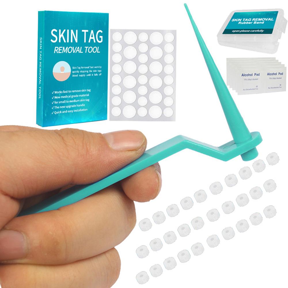 Buy Alcohol Pads Rubber Bands Skin Tag Removal Kit Skin Tag Remover