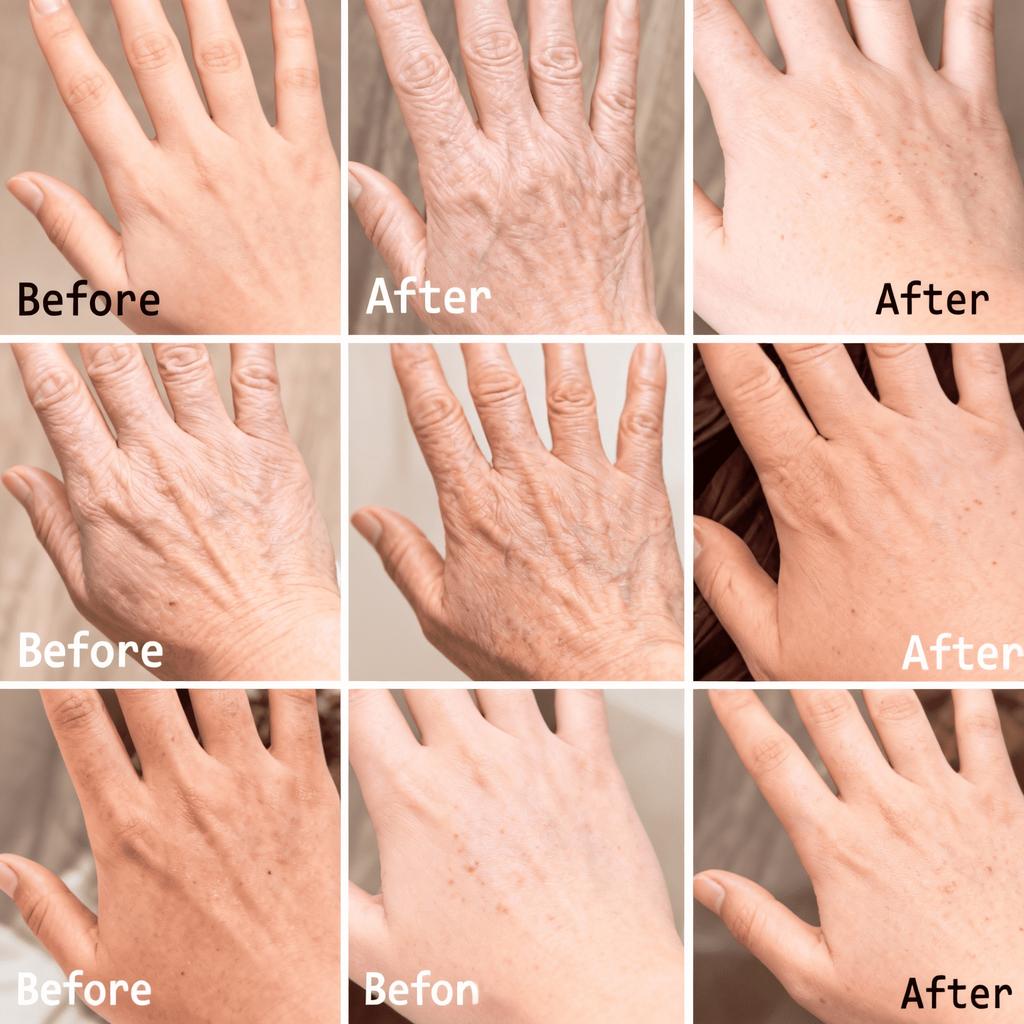 Soin Multifonction pour la Peau – Réparation Intensive pour les Rugosités sur les Mains, les Talons et les Genoux