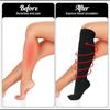 1 para skarpet uciskowych dla kobiet, podkolanówki 15-25 mmHg Pończochy uciskowe dla sportu, sportu, cukrzycy, żylaków, podróży, karmienia piersią