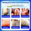 Anti Dry Crack Foot Cream Prevent Cracking Repair Cream Dryness Heel  Exfoliating Remove Dead Repair Cream,Traditional Chinese Cosmetics,plaster