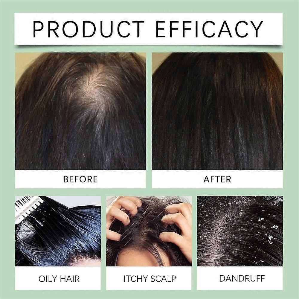 Rosemary Hair Care Scrub with Brush Scalp Massage Treatment Deep Moisturize Repair Damaged Reduce Dry Hair Nourish Scrub Shampoo