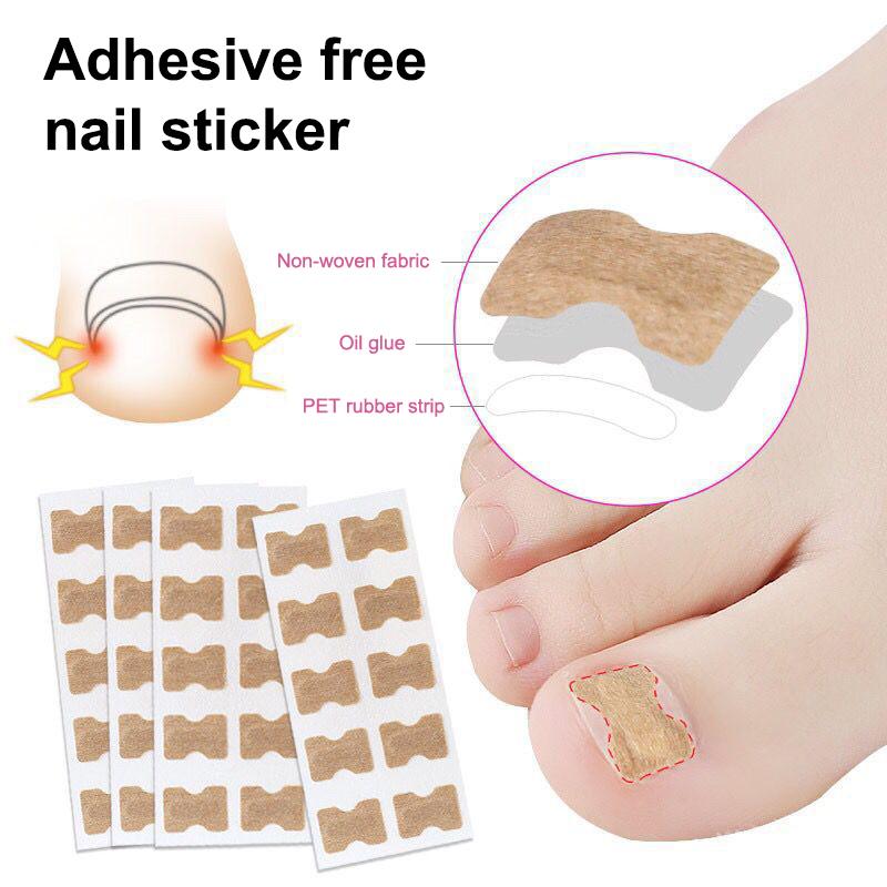 

Professional Ingrown Toenail Foot Corrector Stickers Set Toe Nail Care Pedicure Tools Health Care Protects Paronychia Treatment