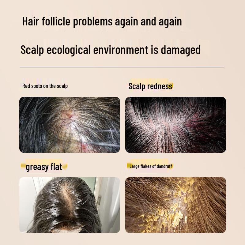 Renhe Therapeutic Scalp Care Shampoo