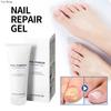 Nail Care Gel Hand Foot Onychomycosis Soft Nail Thickening Nail Luminescent Nail Repair Gel