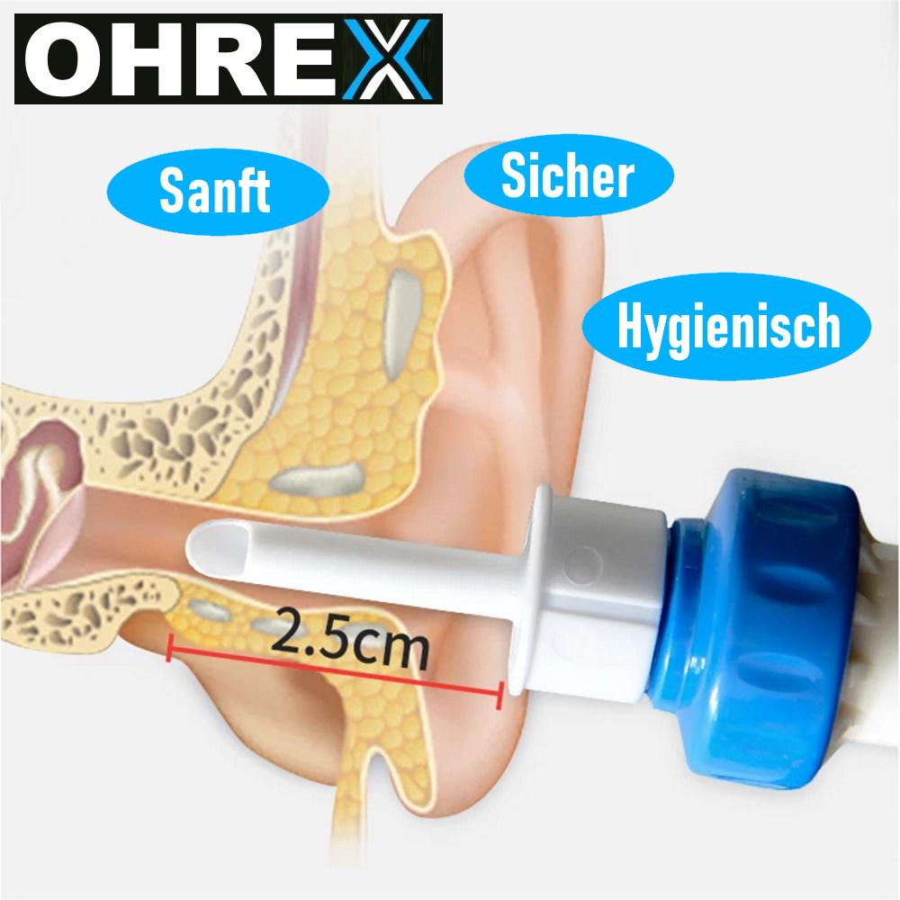 OHREX Elektrischer Ohrenschmalz Entferner Ohrenreiniger Ohrenschmalzentferner