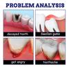 Toothache Spray- Instant Pain Relief Oral Teeth Care Effective Dental Treatment