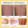Nourishing Moisturizing Skin Cream South Moon Eczema Care Body Hands Feet 30g