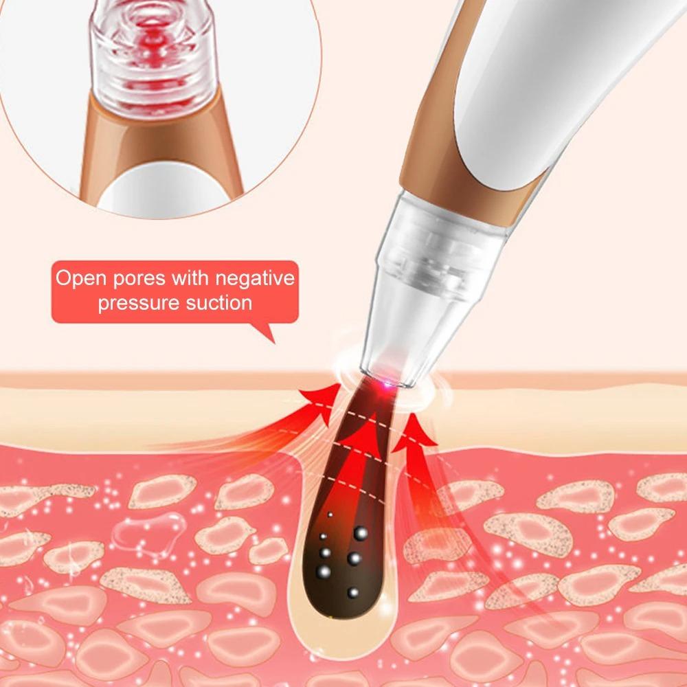 Hot Compress Electric Blackhead Remover With 6 Replacement Head Vacuum Suction Acne Tool  Women