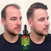 Onion Black Seed Hair Oil Spray for Hair Care and Growth To Prevent Hair Loss