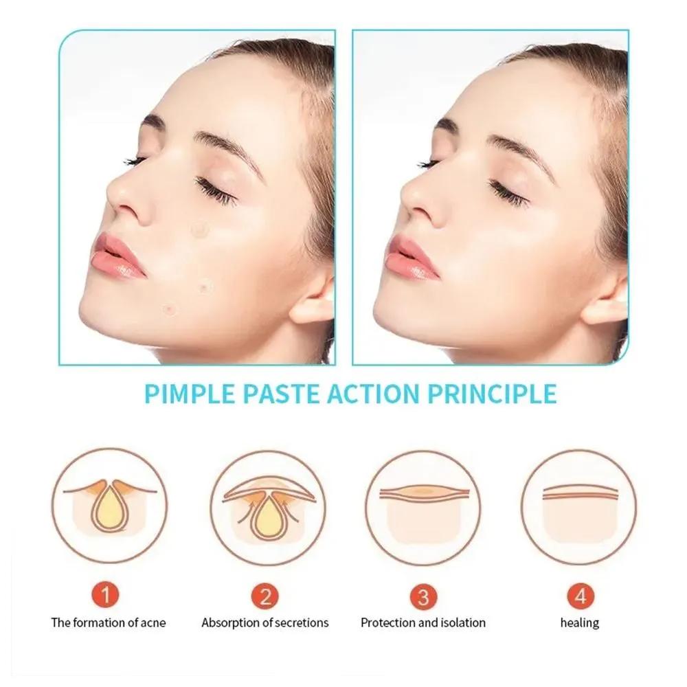 Salicylic acid,patch for face from acne and acne / 60 pcs