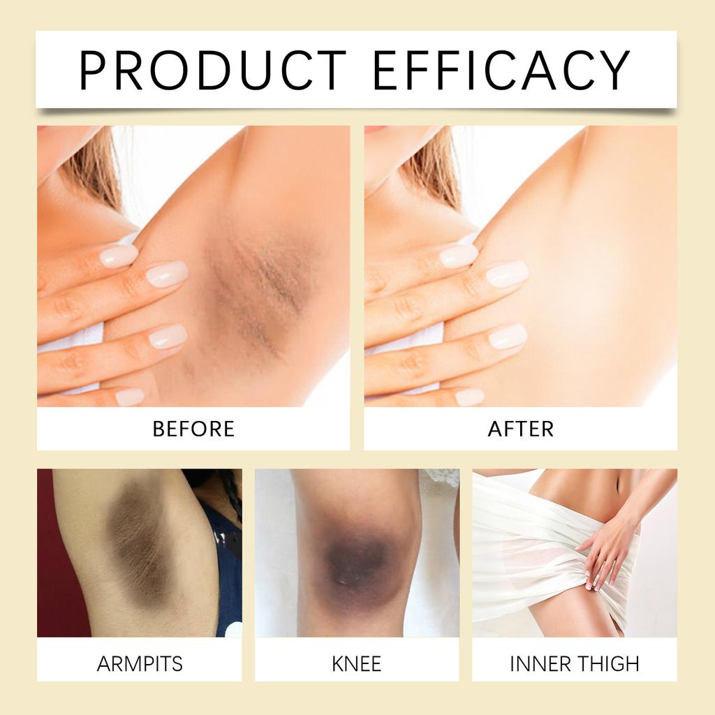 Skin Lightening Pigment Whitening Cream Hydrating Moisturizing Lotion Skin Barrier Deep Moisturizing Private Parts.