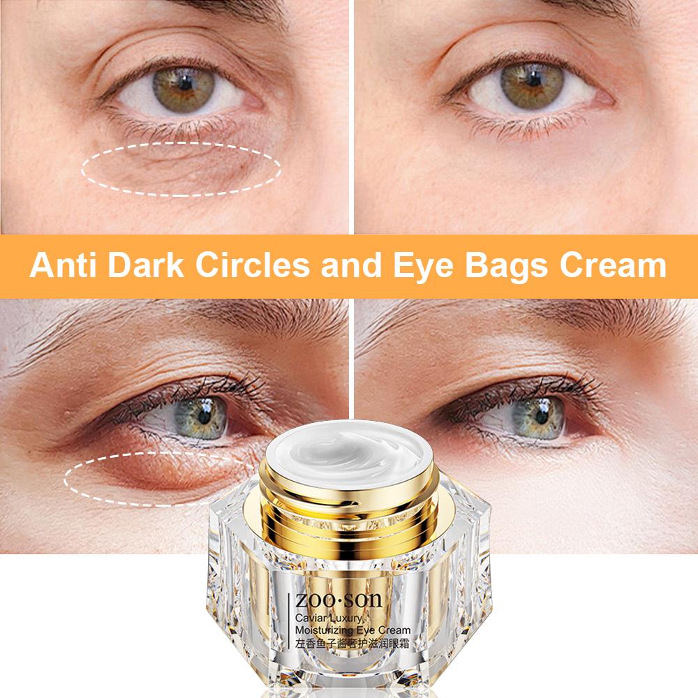 1pcs Polypeptide Caviar Anti-wrinkle Massage Eye Cream To Lift, Tighten and Fade Fine Lines and Dark Circles Eye Care