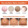 20ml Stretch Marks Oil Nourish Lighten Scars Effective Stretch Mark Repairing Essential Oil for Abdomen