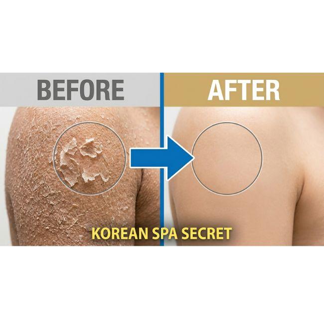 [Songwol] Diamond Exfoliating Towel White Korean Body Scrub Glove Dead Skin Remover Bath Mitt Deep Cleansing 5pcs