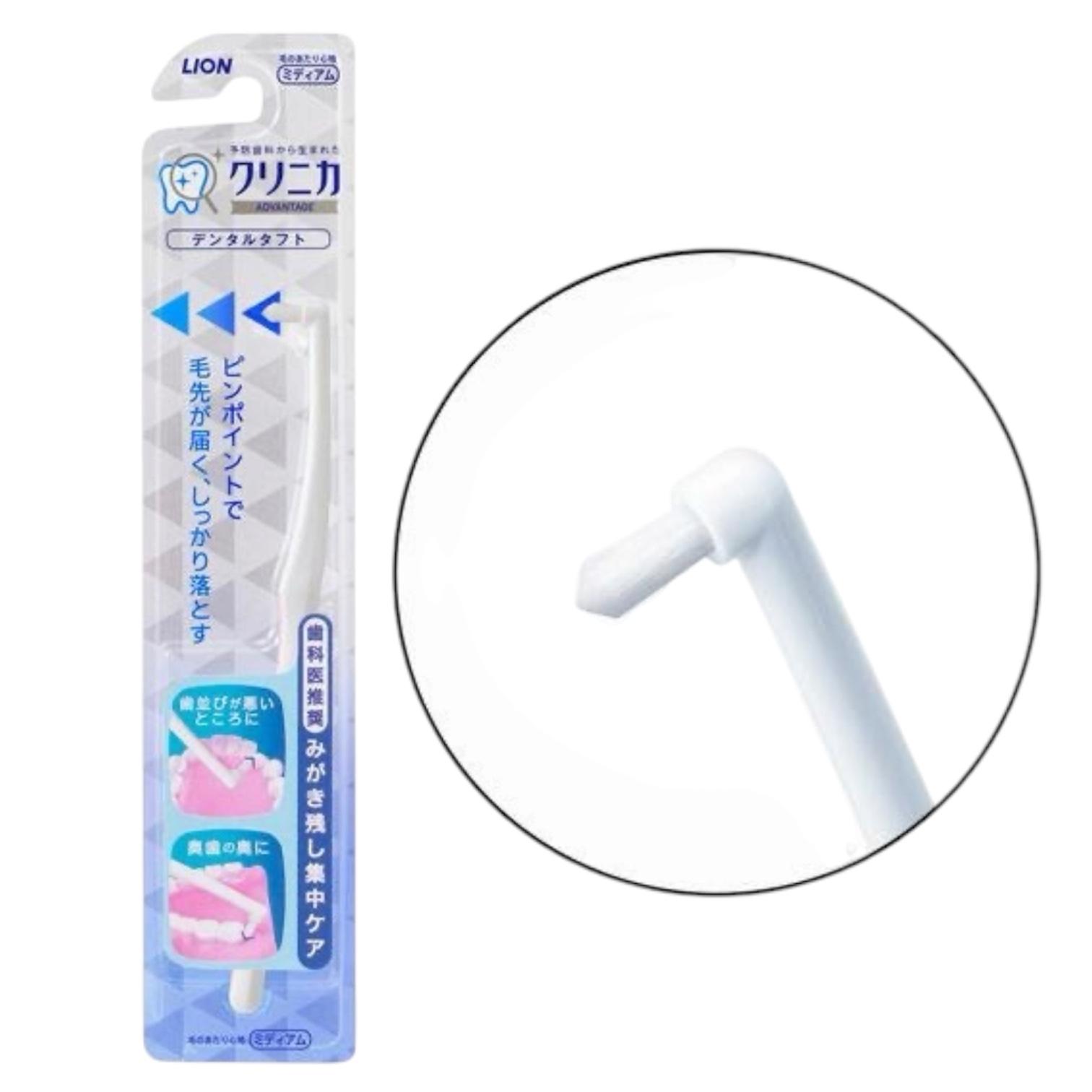 Lion DENT.EX One Tuft Toothbrush, 5 Packs Set (Assorted Colors), Professional Dental Care for Braces & Hard-to-Reach Areas, Made in Japan