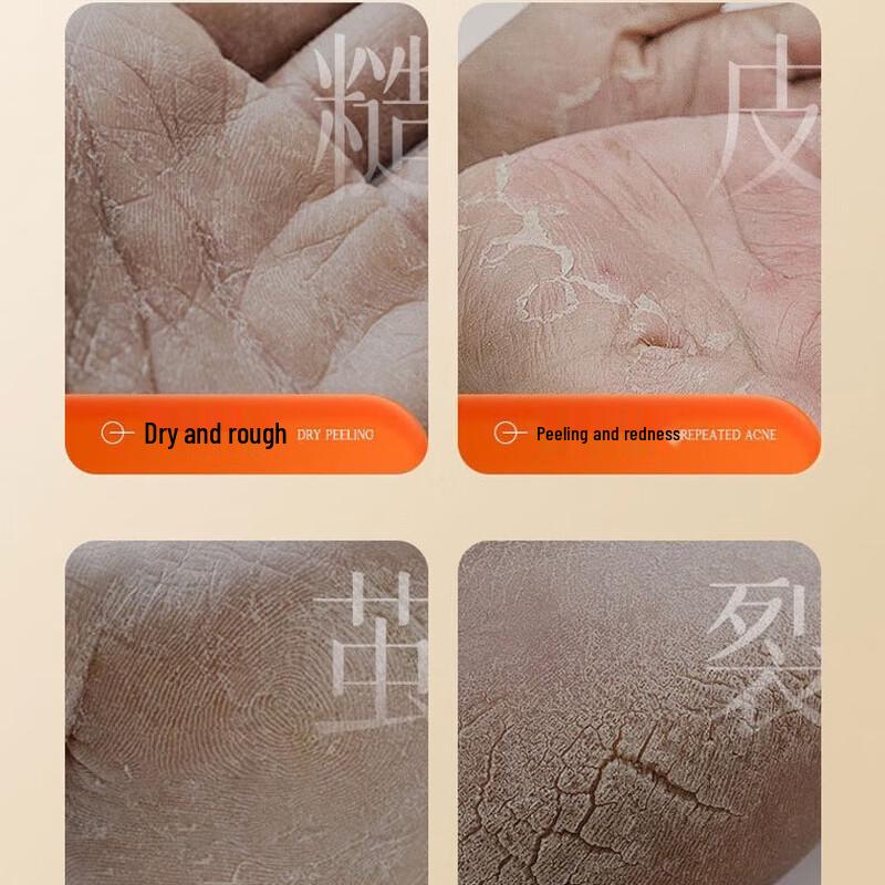 YIMIAOSI Astragalus Softening Hand Cream