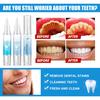 4ML Teeth Cleaning Gel Pen Gum Protection Repair Dental Gel Enamel Safe Teeth Plaque Stain Removal Oral Care Dental Cleaning Gel