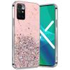 Case for Xiaomi Redmi 10, Glittery, pink