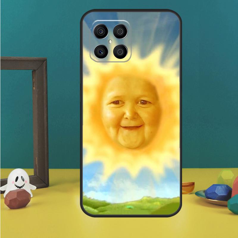 Funny Hasbulla Case For Honor X9c X8a X8b X9b X9a X8 X9 50 70 90 Lite Honor 200 Pro Magic 5 6 7 Lire Cover