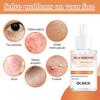Fat Granules Removal Eye Serum Eye Milia Repair Treatment Products Wrinkle Lifting Moisturizing Anti-Puffiness Korean Skin Care