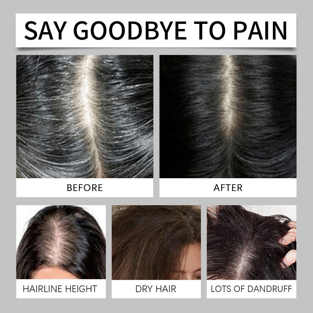 Reisshampoo, Kopfhautreinigung, Massage, feuchtigkeitsspendendes, feuchtigkeitsspendendes und glättendes Haar, pflegendes Shampoo