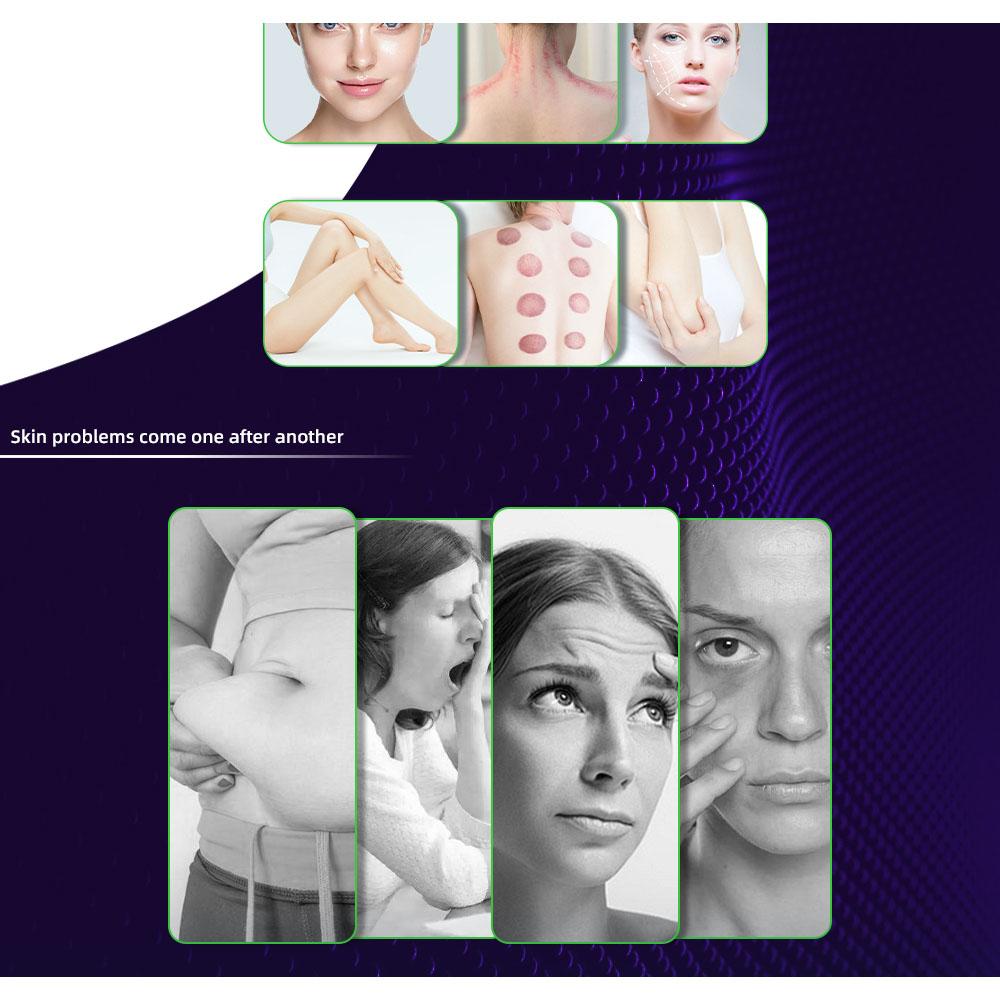 9-in-1 40kHz Cavitation 0.5MHz RF Laser 9 Heads LED Touchscreen Air Cooled 110V-220V AC Salon Body Contouring