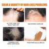 100ml Hair Growth Spray For Men and Women Hair Regrowth Treatment For Stronger Thicker Longer Hair