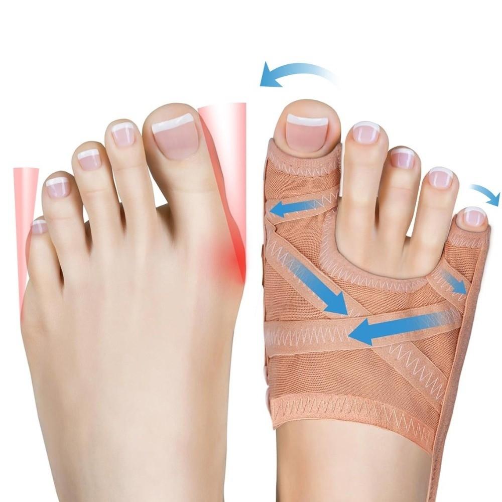 Adjustable Design Bunion Corrector Breathable Hallux Valgus Corrector Toe Straightener Night Use