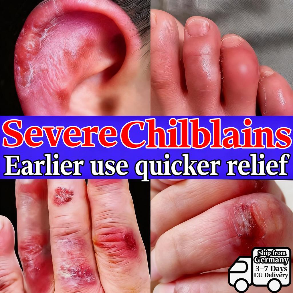 Soothing Salve for Rough Cracked Hands Feet & Frostnip - Natural Herbal Blend