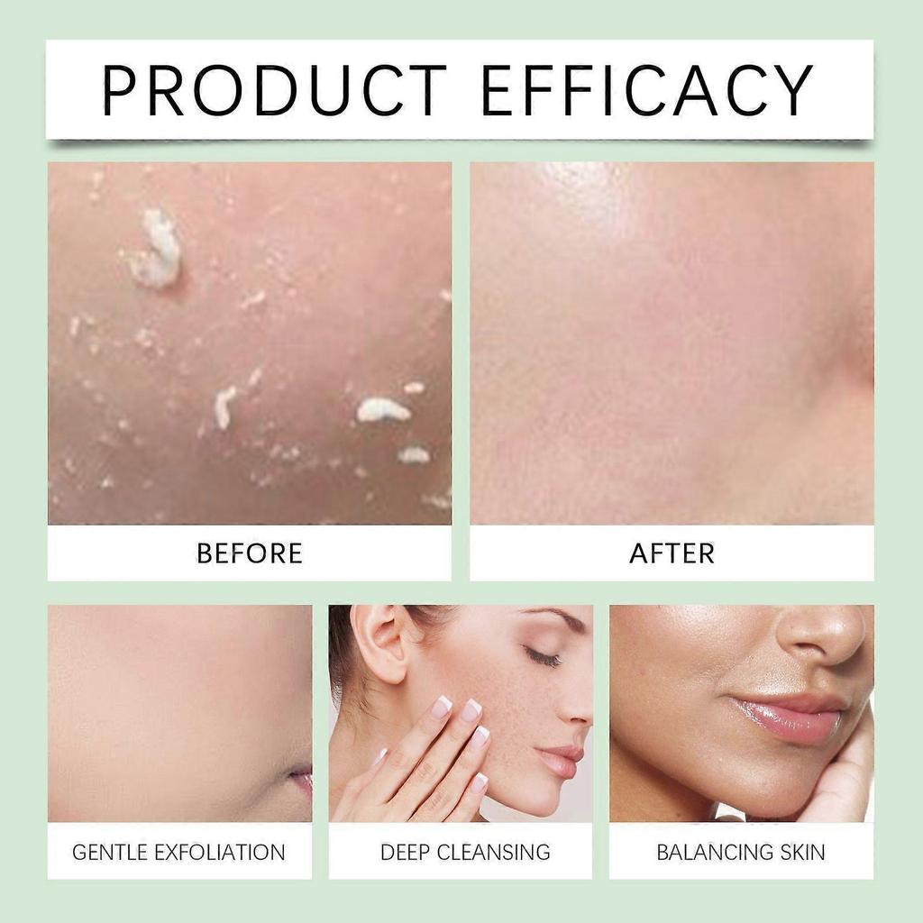 Płatki Zero Pore redukujące duże pory i nierówny koloryt, koreańska pielęgnacja skóry, 70 szt.