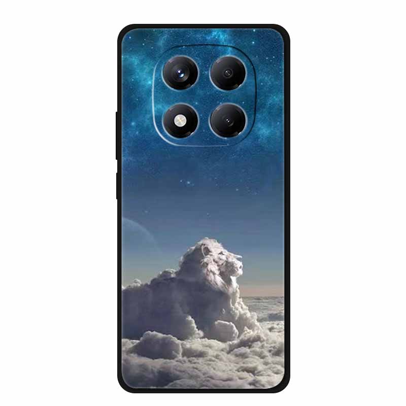 For Xiaomi Redmi Note 15 Pro / Note 15 Pro+ 5G Case Global Version 25060RABDG 2510ERA8BG Luxury Soft Silicone Back Cover Cases