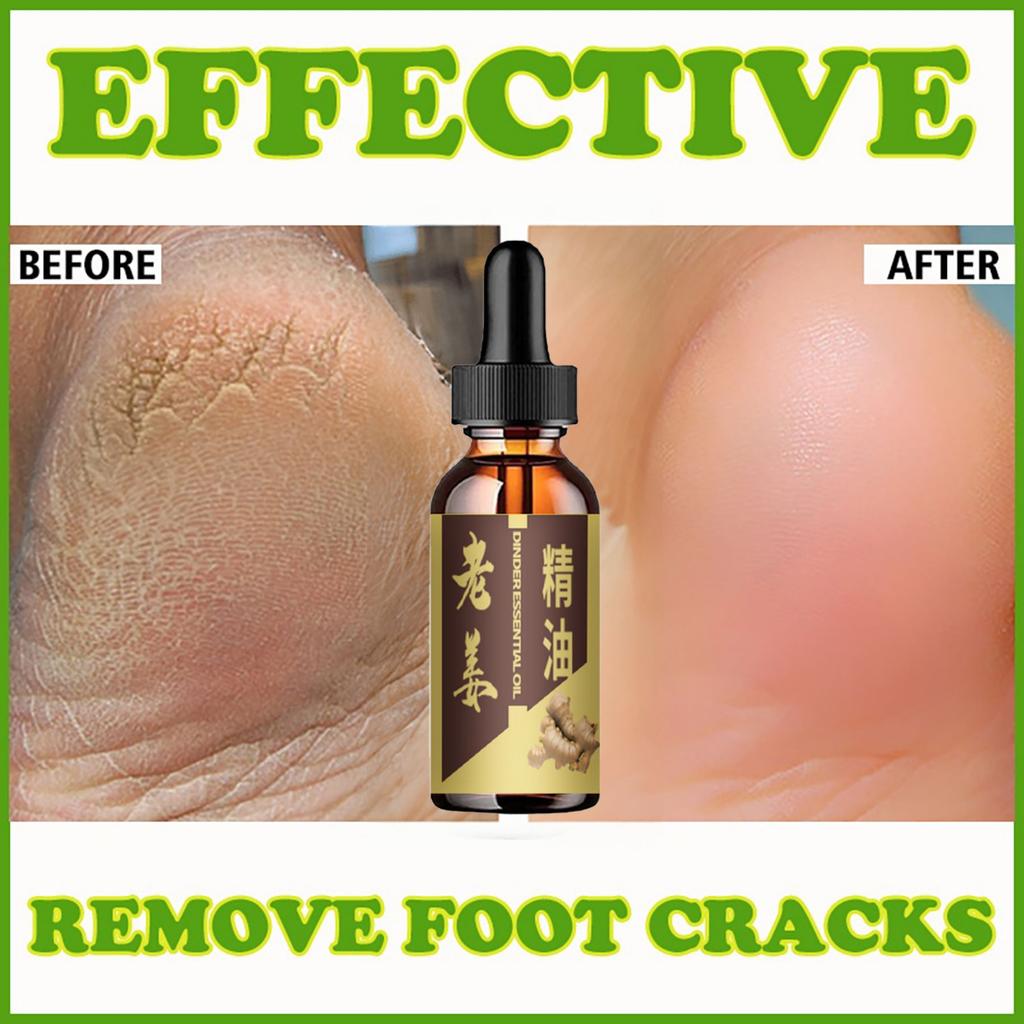 Relieve Foot Odor and Itching with Natural Essential Oils