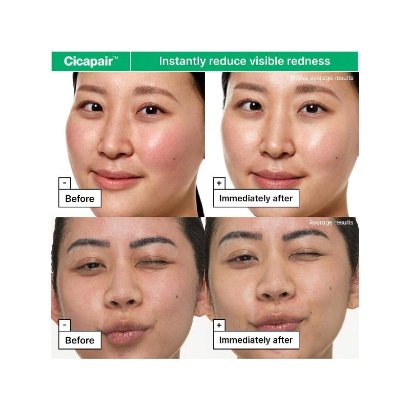 Dr.Jart+ Gesichtsfeuchtigkeitscreme für empfindliche Haut 15ml gegen Rötungen und zur Barrierereparatur mit Centella Asiatica  | Koreanische Hautpflege