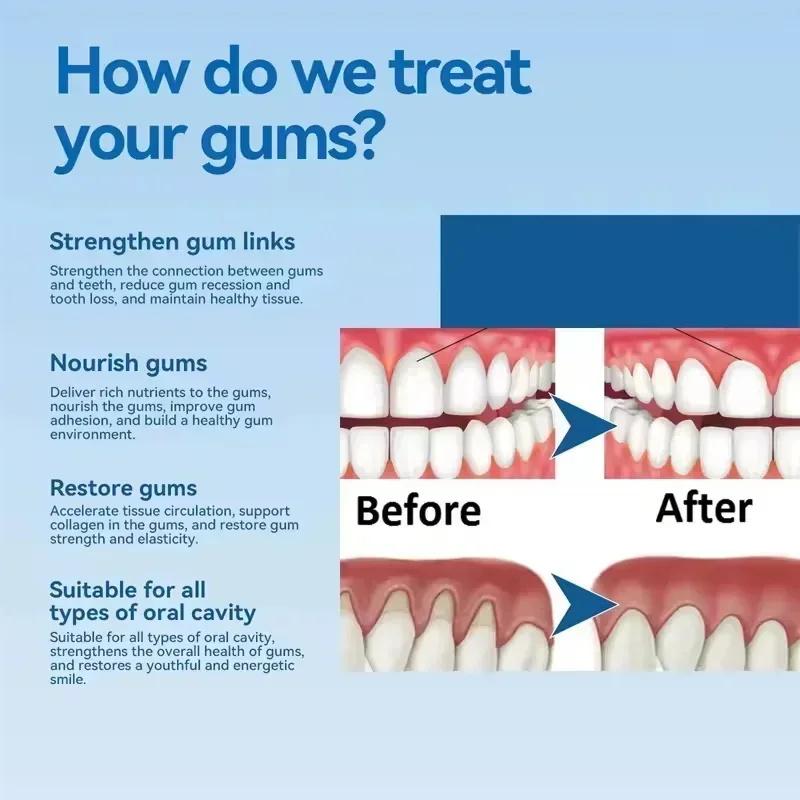 Geschädigtes Zahnfleisch Reparatur Pflege Gel Serum Linderung Schmerzendes Zahnfleisch Allergie Tiefenreinigung Zahnverfärbungen Zahnstein Serum Karies Zahnpasta