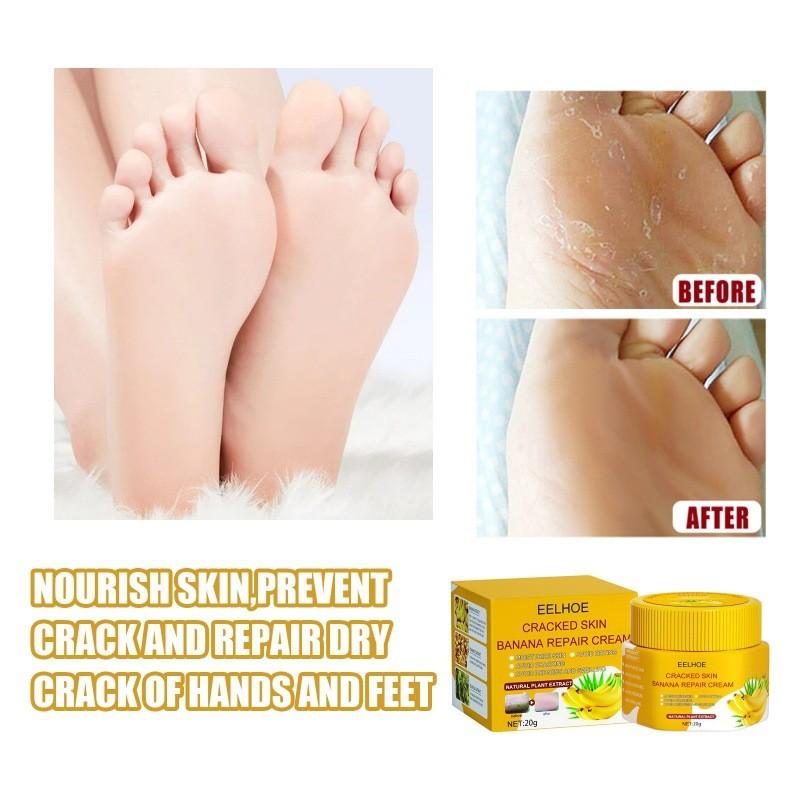 Eelhoe Skin Crack Banana Repair Cream Nourishing Foot Cream For Dry Cracked Skin