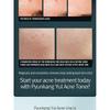 Pyunkang Yul Acne Toner 150ml