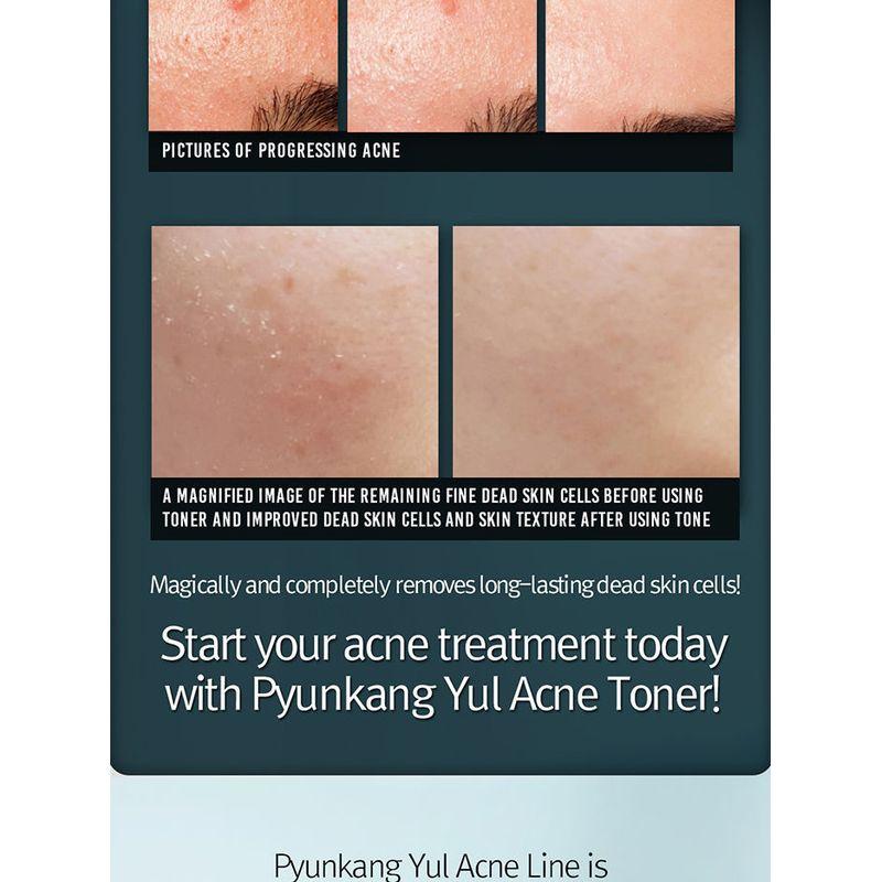 Pyunkang Yul Acne Toner 150ml