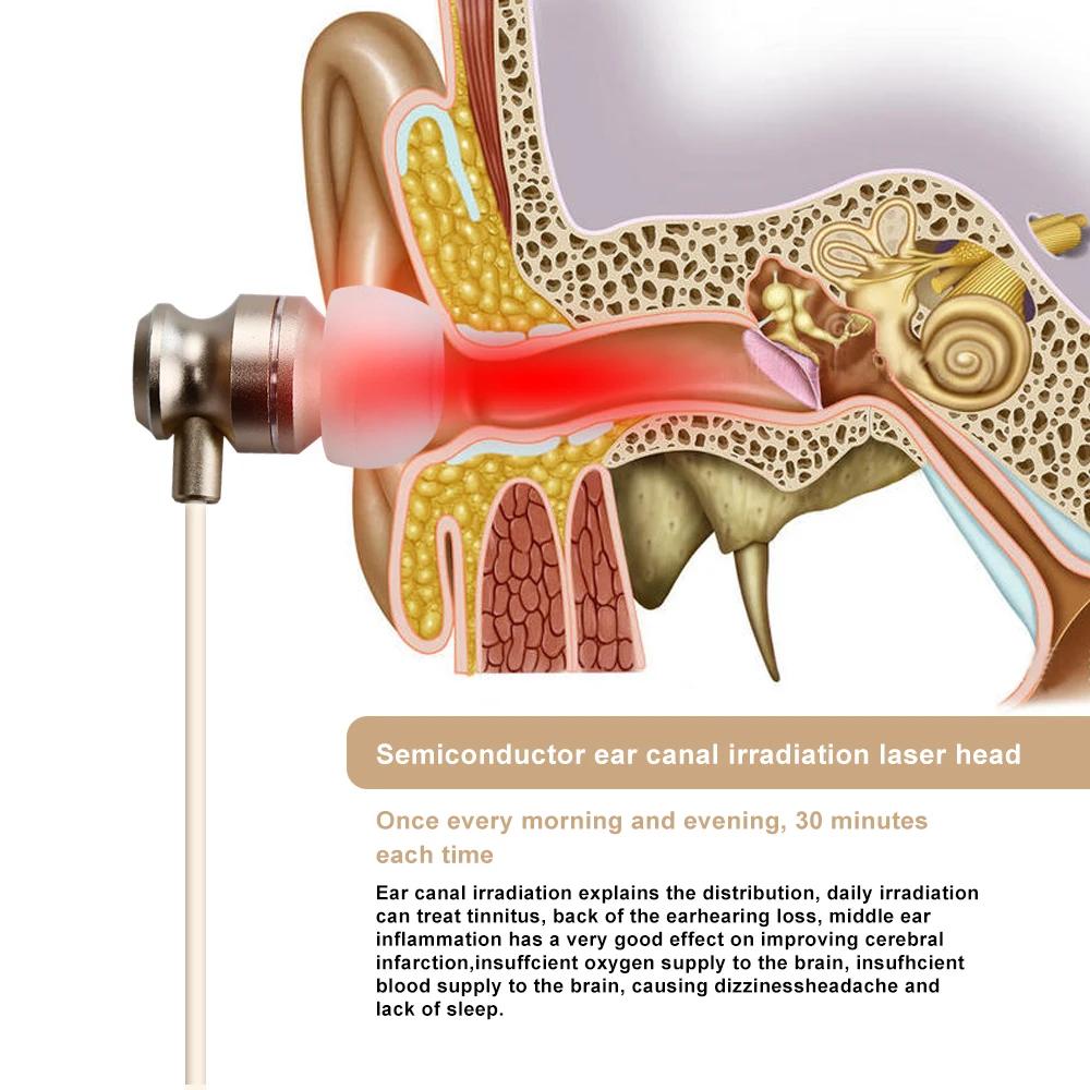 Portable 650nm Red Light Ear Comfort Device Rechargeable Adjustable Intensity for Personal Relaxation and Ear Care Home Use