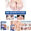 Ximonth Nagelreparaturpflaster zur Verdickung weicher Nägel und zur Behandlung von Nagelpilz mit 60 Pflastern