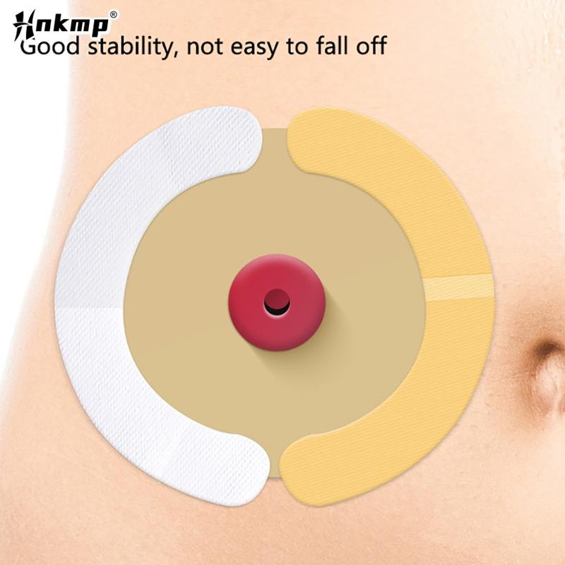 20 Stück/Karton Elastische Stoma-Barriere-Streifen Hydrokolloid Wasserdicht Auslaufsicher Hautklebend Stoma-Barriere-Band Für Kolostomiebeutel