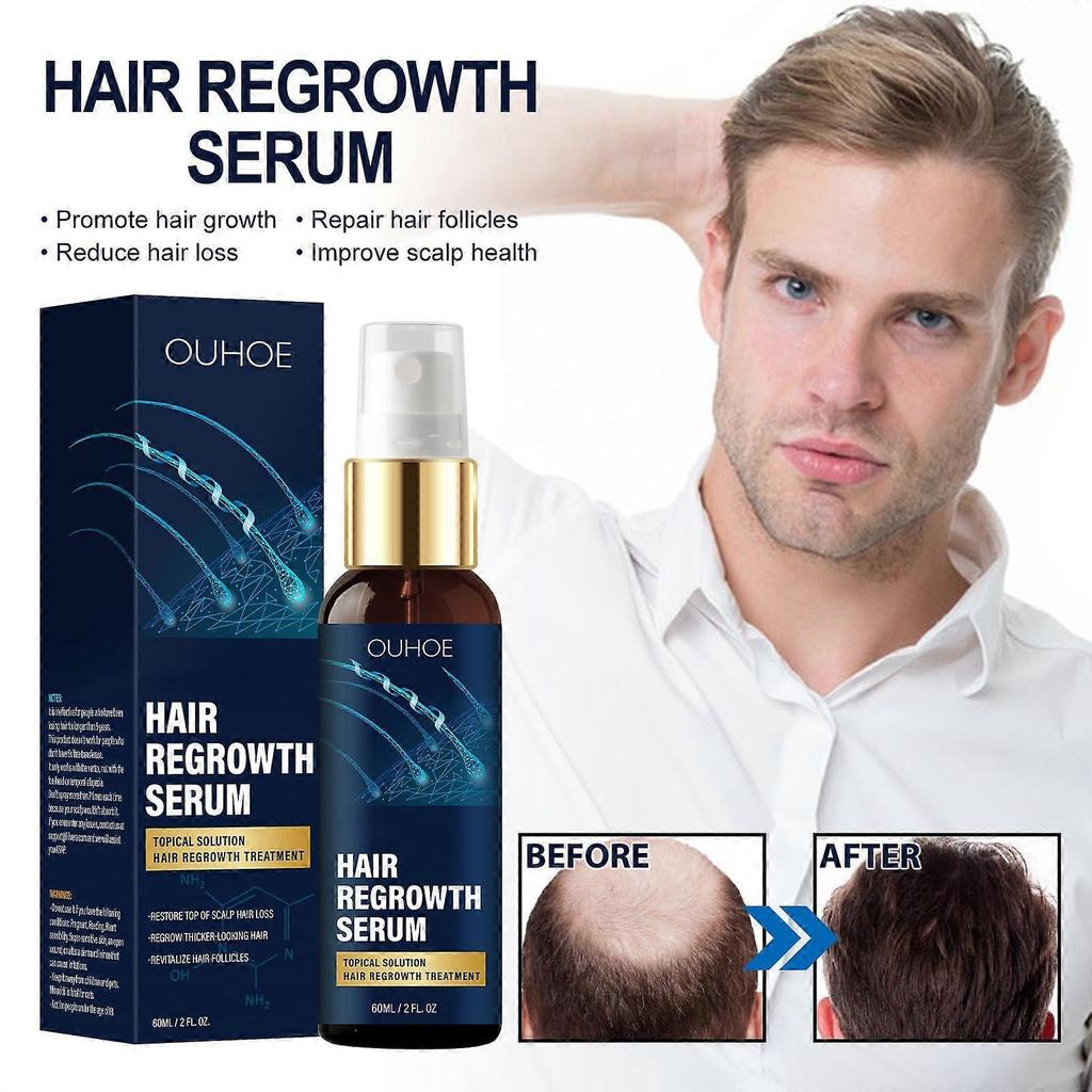 Limited time!!Ouhoe Anti-Hair Loss Density Essence - Nourishes Hairline, Moisturizes Dry Hair, Repairs Hair Roots, And Promotes Hair Growth