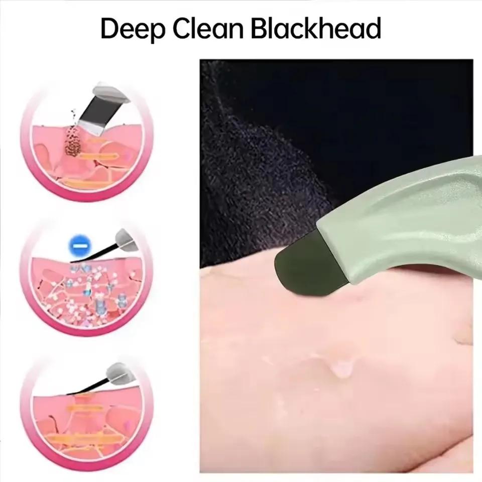 Facial Blackhead Removal Tool Face Scraper for Deep Cleansing Face Spatula Nose Whitehead Remover Skin Care Beauty Tools