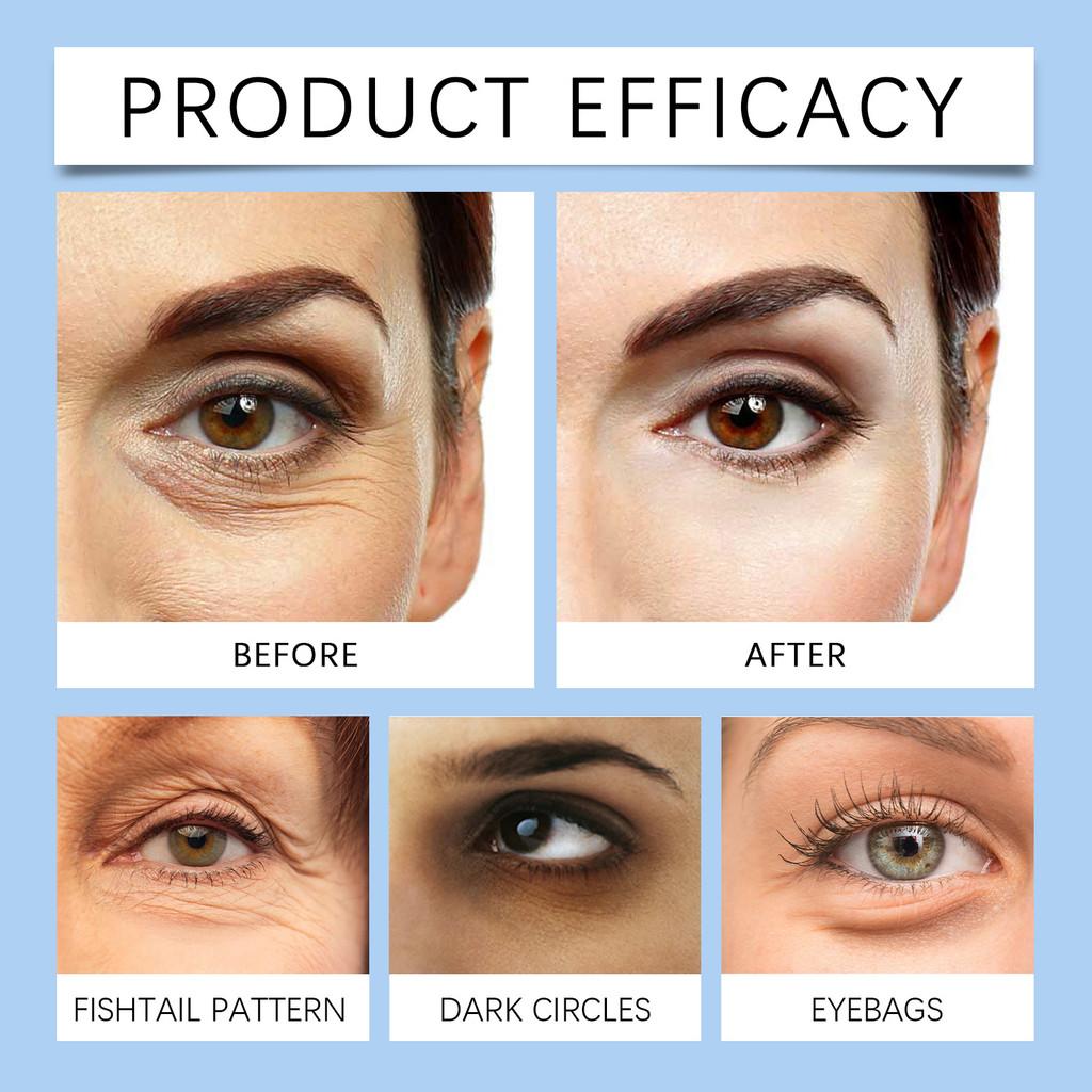 Hoygi Hydrating Eye Masks For Moisturizing And Revitalizing Dull Skin Under Eyes