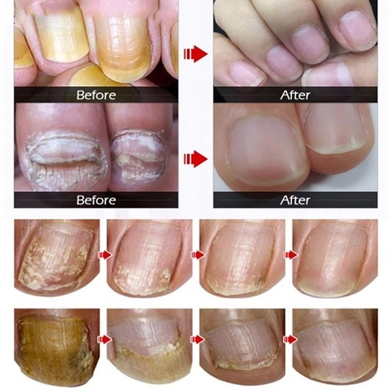 Výživa nehtů, čištění a hydratace, zklidňující hydratace, výživa nehtů, nehty tvrdé a lesklé