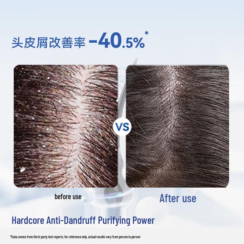 JD-hergestelltes Herren Ice-Feel Anti-Schuppen Shampoo