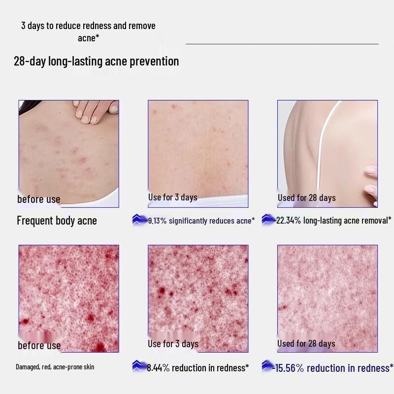 EHD Salicylic Acid Acne Clarifying Body Wash
