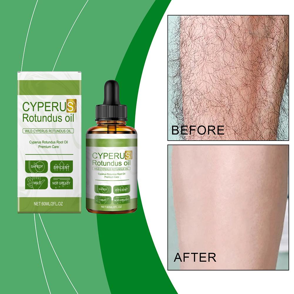 Cyperus Oil Moisturizing Nourishing Body Hair Removal Rotundus Reduce Care Smoothing Oil Cyperu G5W8
