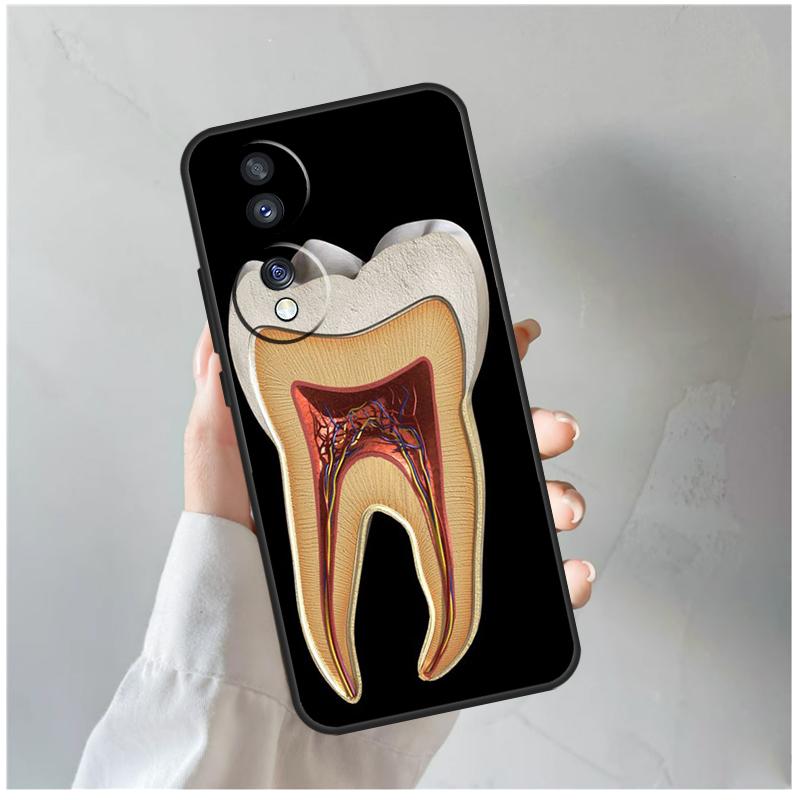Human Tooth Anatomy For Honor Magic 8 7 6 5 Pro Case For Honor 400 200 Lite 90 70 50 X8c X8b X9a X9b X9c X9d Win