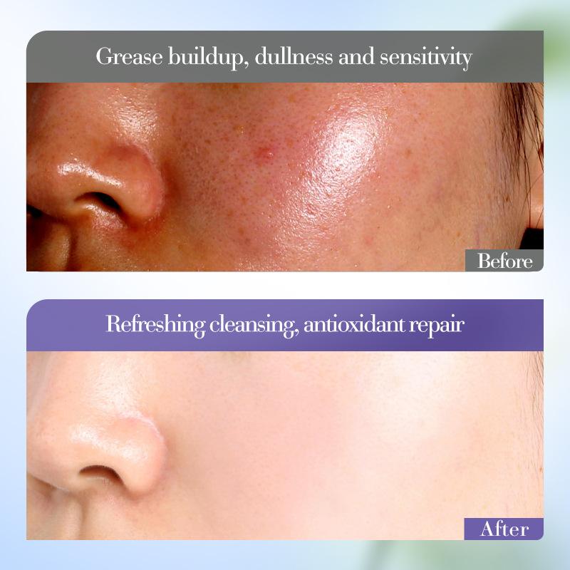Blueberry Amino Acid Cleanser SADOER Gentle Antioxidant Cleansing Facial Cleanser