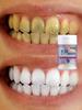 5D Bright White Tooth Powder, Deep Cleaning, Oral Protection, Bright White Teeth, Fresh Breath